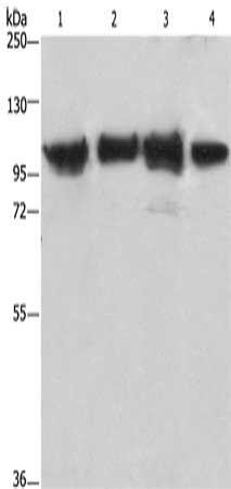 Gel: 6%SDS-PAGE, Lysate: 40μg, Lane 1-4: Lovo cells, mouse kidney tissue, 231 cells, hepG2 cells, Primary antibody: ACTN4 Antibody(ACTN4 Antibody) at dilution 1/485, Secondary antibody: Goat anti rabbit IgG at 1/8000 dilution, Exposure time: 10 seconds
