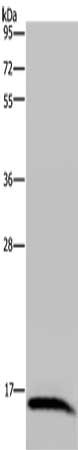Gel: 10%SDS-PAGE, Lysate: 40 μg, Lane: Human hepatocellular carcinoma tissue, Primary antibody: IRGM Antibody(IRGM Antibody) at dilution 1/200, Secondary antibody: Goat anti rabbit IgG at 1/8000 dilution, Exposure time: 5 minutes