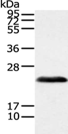 Gel: 12%SDS-PAGE, Lysate: 40 μg, Lane: Human fetal brain tissue, Primary antibody: VHL Antibody(VHL Antibody) at dilution 1/200 dilution, Secondary antibody: Goat anti rabbit IgG at 1/8000 dilution, Exposure time: 1 secondRabbit anti-Human VHL Polyclonal Antibody