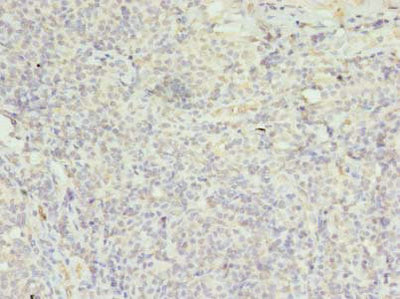 Immunohistochemistry of paraffin-embedded human tonsil tissue using FPR1 Antibody at dilution of 1:100Rabbit anti-Human FPR1 Polyclonal Antibody