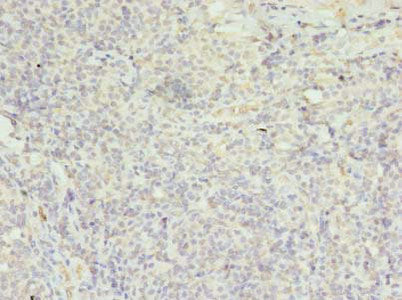 Immunohistochemistry of paraffin-embedded human tonsil tissue using FPR1 Antibody at dilution of 1:100Rabbit anti-Human FPR1 Polyclonal Antibody