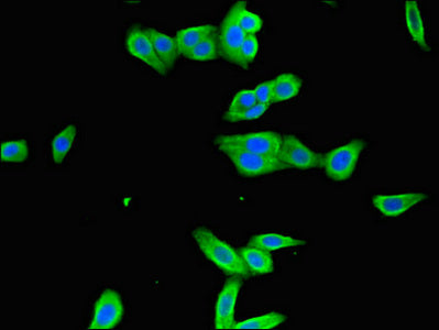 Immunofluorescent analysis of HepG2 cells using ICAM1 Antibody at dilution of 1:100 and Alexa Fluor 488-congugated AffiniPure Goat Anti-Rabbit IgG(H+L)Rabbit anti-Human ICAM1 Polyclonal Antibody