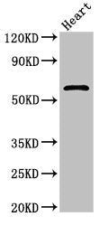 Western Blot | Positive WB detected in: Rat heart tissue | All lanes: ICAM1 antibody at 2.4μg/ml | Secondary | Goat polyclonal to rabbit IgG at 1/50000 dilution | Predicted band size: 58 kDa | Observed band size: 58 kDaRabbit anti-Human ICAM1 Polyclonal Antibody