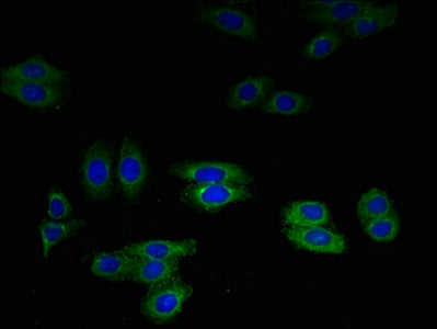 Immunofluorescent analysis of HepG2 cells using SLPI Antibody at dilution of 1:100 and Alexa Fluor 488-congugated AffiniPure Goat Anti-Rabbit IgG(H+L)Rabbit anti-Human SLPI Polyclonal Antibody