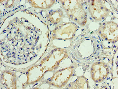 Immunohistochemistry of paraffin-embedded human kidney tissue using APP Antibody at dilution of 1:100Rabbit anti-Human APP Polyclonal Antibody
