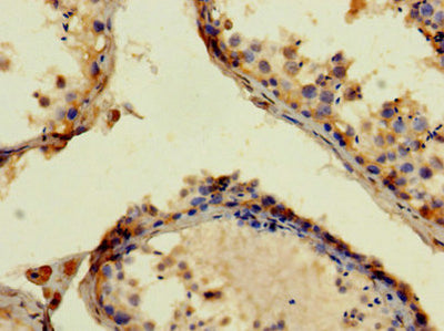 Immunohistochemistry of paraffin-embedded human testis tissue using APP Antibody at dilution of 1:100Rabbit anti-Human APP Polyclonal Antibody