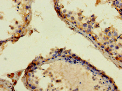Immunohistochemistry of paraffin-embedded human testis tissue using APP Antibody at dilution of 1:100Rabbit anti-Human APP Polyclonal Antibody