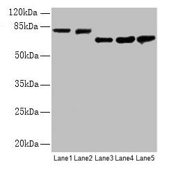 Western blot  | All lanes: APP antibody at 2.4µg/ml  | Lane 1: Mouse brain tissue  | Lane 2: 293 whole cell lysate  | Lane 3: A549 whole cell lysate  | Lane 4: U251 whole cell lysate  | Lane 5: SH-SY5Y whole cell lysate  | Secondary  | Goat polyclonal to rabbit IgG at 1/15000 dilution  | Predicted band size: 87, 35, 77, 79, 81, 83, 85, 86, 73 kDa  | Observed band size: 81, 73 kDaRabbit anti-Human APP Polyclonal Antibody