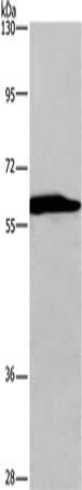 Gel: 6%SDS-PAGE, Lysate: 40 μg, Lane: NIH/3T3 cells, Primary antibody: PRKAA1 Antibody(PRKAA1 Antibody) at dilution 1/200, Secondary antibody: Goat anti rabbit IgG at 1/8000 dilution, Exposure time: 1 minuteRabbit anti-Human PRKAA1 Polyclonal Antibody