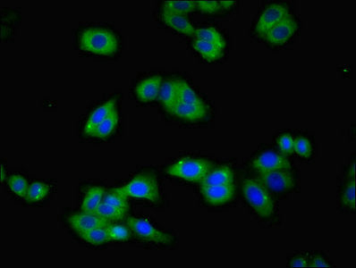Immunofluorescent analysis of HepG2 cells using TFRC Antibody at dilution of 1:100 and Alexa Fluor 488-congugated AffiniPure Goat Anti-Rabbit IgG(H+L)Rabbit anti-Human TFRC Polyclonal Antibody