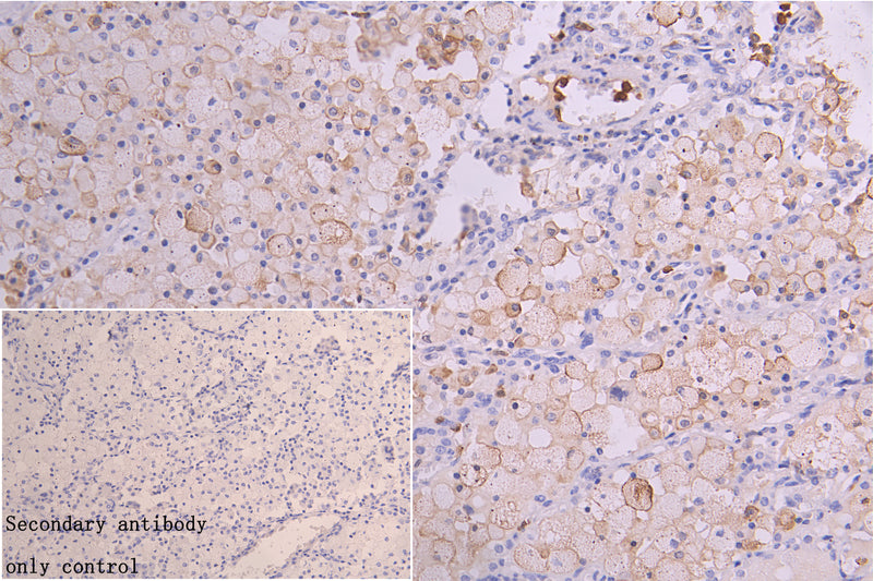Immunohistochemistry of paraffin-embedded human placenta tissue using the antibody at dilution of 1:100Rabbit anti-Human TFRC Polyclonal Antibody