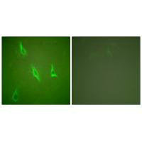 Immunofluorescence analysis of HeLa cells, using Caspase 10 antibody.Rabbit anti-Human CASP10 Polyclonal Antibody