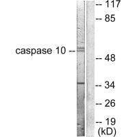 Western blot analysis of extracts from HeLa cells, using Caspase 10 antibody.Rabbit anti-Human CASP10 Polyclonal Antibody