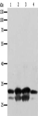 Gel: 10%SDS-PAGE, Lysate: 30 μg, Lane 1-4: Hela cells, 293T cells, Human fetal brain tissue, Mouse brain tissue, Primary antibody: YWHAE Antibody(YWHAE Antibody) at dilution 1/250, Secondary antibody: Goat anti rabbit IgG at 1/8000 dilution, Exposure time: 10 secondsRabbit anti-Human YWHAE Polyclonal Antibody
