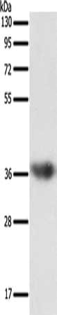 Gel: 10%SDS-PAGE, Lysate: 40 μg, Lane: Human liver cancer tissue, Primary antibody: SULT1E1 Antibody(SULT1E1 Antibody) at dilution 1/500, Secondary antibody: Goat anti rabbit IgG at 1/8000 dilution, Exposure time: 1 minuteRabbit anti-Human SULT1E1 Polyclonal Antibody