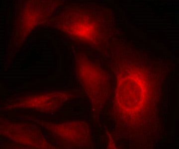 Immunofluorescence staining of methanol-fixed Hela cells showing cytoplasmic staining using HSP27(Phospho-Ser15) Antibody.Rabbit anti-Human HSPB1 Polyclonal Antibody