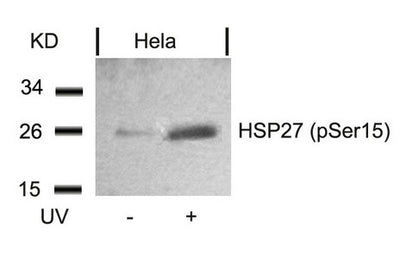 Western blot analysis of extracts from Hela cells untreated or treated with UV using HSP27(Phospho-Ser15) Antibody.Rabbit anti-Human HSPB1 Polyclonal Antibody
