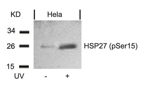 Western blot analysis of extracts from Hela cells untreated or treated with UV using HSP27(Phospho-Ser15) Antibody.Rabbit anti-Human HSPB1 Polyclonal Antibody