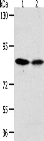 Gel: 10%SDS-PAGE, Lysate: 50 μg, Lane 1-2: Hela cells, SKOV3 cells, Primary antibody: ADAM11 Antibody(ADAM11 Antibody) at dilution 1/500, Secondary antibody: Goat anti rabbit IgG at 1/8000 dilution, Exposure time: 10 minutes