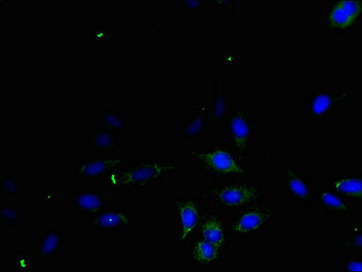 Immunofluorescent analysis of Hela cells using TGFA Antibody at dilution of 1:100 and Alexa Fluor 488-congugated AffiniPure Goat Anti-Rabbit IgG(H+L)Rabbit anti-Human TGFA Polyclonal Antibody
