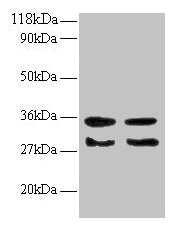 Western blot  | All lanes: TGFA antibody at 2µg/ml  | Lane 1: EC109 whole cell lysate  | Lane 2: 293T whole cell lysate  | Secondary  | Goat polyclonal to rabbit IgG at 1/15000 dilution  | Predicted band size: 18, 17 kDa  | Observed band size: 30, 35 kDaRabbit anti-Human TGFA Polyclonal Antibody