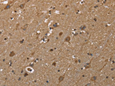 The image on the left is immunohistochemistry of paraffin-embedded Human brain  tissue using GALK1 Antibody(GALK1 Antibody) at dilution 1/40, on the right is treated with fusion protein. (Original magnification: ×200)Rabbit anti-Human GALK1 Polyclonal Antibody