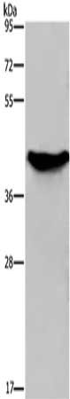 Gel: 8%SDS-PAGE, Lysate: 40 μg, Lane: Human fetal liver tissue, Primary antibody: GALK1 Antibody(GALK1 Antibody) at dilution 1/450, Secondary antibody: Goat anti rabbit IgG at 1/8000 dilution, Exposure time: 30 secondsRabbit anti-Human GALK1 Polyclonal Antibody