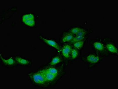 Immunofluorescent analysis of Hela cells using TIMP4 Antibody at dilution of 1:100 and Alexa Fluor 488-congugated AffiniPure Goat Anti-Rabbit IgG(H+L)Rabbit anti-Human TIMP4 Polyclonal Antibody