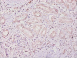 Immunohistochemistry of paraffin-embedded human kidney tissue using TIMP4 Antibody at dilution of 1:100Rabbit anti-Human TIMP4 Polyclonal Antibody