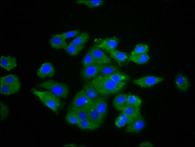 Immunofluorescence staining of HepG2 cells with TNF Antibody at 1:133, counter-stained with DAPI. The cells were fixed in 4% formaldehyde, permeabilized using 0.2% Triton X-100 and blocked in 10% normal Goat Serum. The cells were then incubated with the antibody overnight at 4°C. The secondary antibody was Alexa Fluor 488-congugated AffiniPure Goat Anti-Rabbit IgG(H+L).Rabbit anti-Human TNF Polyclonal Antibody
