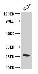 Western Blot  | Positive WB detected in: Hela whole cell lysate  | All lanes: TNF antibody at 3.2µg/ml  | Secondary  | Goat polyclonal to rabbit IgG at 1/50000 dilution  | Predicted band size: 26 kDa  | Observed band size: 26 kDaRabbit anti-Human TNF Polyclonal Antibody