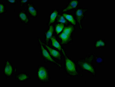 Immunofluorescent analysis of A549 cells using L1CAM Antibody at dilution of 1:100 and Alexa Fluor 488-congugated AffiniPure Goat Anti-Rabbit IgG(H+L)