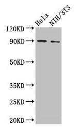 Western Blot  | Positive WB detected in: Hela whole cell lysate, NIH/3T3 whole cell lysate  | All lanes: L1CAM antibody at 2µg/ml  | Secondary  | Goat polyclonal to rabbit IgG at 1/50000 dilution  | Predicted band size: 141, 140, 139 kDa  | Observed band size: 90 kDa