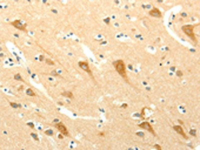 The image on the left is immunohistochemistry of paraffin-embedded Human brain tissue using the antibody Antibody) at dilution 1/15, on the right is treated with fusion protein. (Original magnification: ×200)Rabbit anti-Human SYT5 Polyclonal Antibody