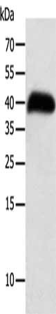 Gel: 10%SDS-PAGE, Lysate: 40 μg, Lane: Human thigh malignant fibrous histiocytoma tissue, Primary antibody: SYT5 Antibody(SYT5 Antibody) at dilution 1/100, Secondary antibody: Goat anti rabbit IgG at 1/8000 dilution, Exposure time: 8 hoursRabbit anti-Human SYT5 Polyclonal Antibody