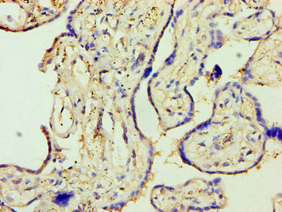 Immunohistochemistry of paraffin-embedded human placenta tissue using MMP3 Antibody at dilution of 1:100Rabbit anti-Human MMP3 Polyclonal Antibody