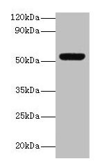 Western blot  | All lanes: MMP3 antibody at 2µg/ml + Mouse liver tissue  | Secondary  | Goat polyclonal to rabbit lgG at 1/15000 dilution  | Predicted band size: 54 kDa  | Observed band size: 54 kDaRabbit anti-Human MMP3 Polyclonal Antibody