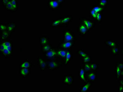 Immunofluorescence staining of Hela cells with PLAUR Antibody at 1:133, counter-stained with DAPI. The cells were fixed in 4% formaldehyde, permeabilized using 0.2% Triton X-100 and blocked in 10% normal Goat Serum. The cells were then incubated with the antibody overnight at 4°C. The secondary antibody was Alexa Fluor 488-congugated AffiniPure Goat Anti-Rabbit IgG(H+L).Rabbit anti-Human PLAUR Polyclonal Antibody