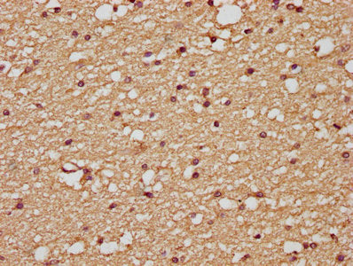 IHC image of the antibody diluted at 1:200 and staining in paraffin-embedded human brain tissue performed on a Leica BondTM system. After dewaxing and hydration, antigen retrieval was mediated by high pressure in a citrate buffer (pH 6.0). Section was blocked with 10% normal goat serum 30min at RT. Then primary antibody (1% BSA) was incubated at 4°C overnight. The primary is detected by a biotinylated secondary antibody and visualized using an HRP conjugated SP system.Rabbit anti-Human PLAUR Polyclonal Antibody