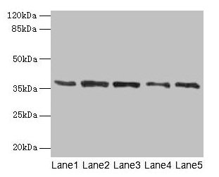 Western blot  | All lanes: PLAUR antibody at 4µg/ml  | Lane 1: Mouse brain tissue  | Lane 2: A2780 whole cell lysate  | Lane 3: MCF-7 whole cell lysate  | Lane 4: Hela whole cell lysate  | Lane 5: Colo320 whole cell lysate  | Secondary  | Goat polyclonal to rabbit IgG at 1/10000 dilution  | Predicted band size: 37, 32, 33 kDa  | Observed band size: 37 kDaRabbit anti-Human PLAUR Polyclonal Antibody