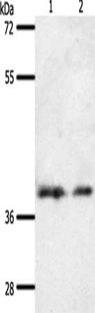 Gel: 10%SDS-PAGE, Lysate: 60 μg, Lane 1-2: 293T cells, hela cells, Primary antibody: SSTR1 Antibody(SSTR1 Antibody) at dilution 1/500, Secondary antibody: Goat anti rabbit IgG at 1/8000 dilution, Exposure time: 30 secondsRabbit anti-Human SSTR1 Polyclonal Antibody
