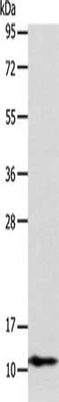 Gel: 12%SDS-PAGE, Lysate: 40 μg, Lane: Lovo cells, Primary antibody: ATP5J Antibody(ATP5J Antibody) at dilution 1/200, Secondary antibody: Goat anti rabbit IgG at 1/8000 dilution, Exposure time: 5 minutes