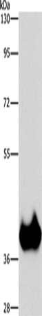 Gel: 8%SDS-PAGE, Lysate: 40 μg, Lane: Mouse brain tissue, Primary antibody: ASPA Antibody(ASPA Antibody) at dilution 1/1150, Secondary antibody: Goat anti rabbit IgG at 1/8000 dilution, Exposure time: 5 secondsRabbit anti-Human ASPA Polyclonal Antibody