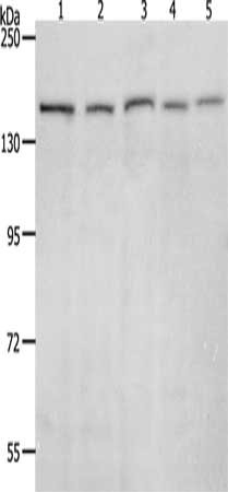 Gel: 8%SDS-PAGE, Lysate: 40 μg, Lane 1-5: 293T cells, Hela cells, K562 cells, NIH/3T3 cells, RAW264.7 cells, Primary antibody: RAD50 Antibody(RAD50 Antibody) at dilution 1/900, Secondary antibody: Goat anti rabbit IgG at 1/8000 dilution, Exposure time: 5 minutesRabbit anti-Human RAD50 Polyclonal Antibody