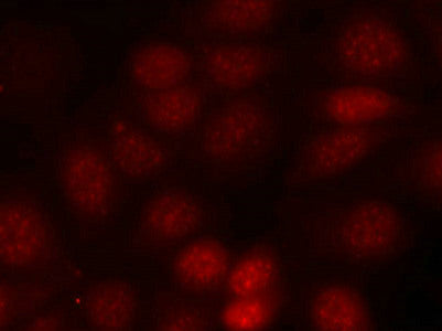 Immunofluorescence staining of methanol-fixed MCF cells using p70 S6 Kinase(Phospho-Thr421) Antibody.Rabbit anti-Human RPS6KB1 Polyclonal Antibody