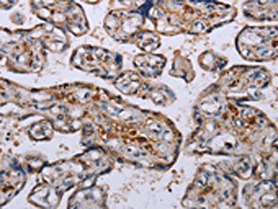 The image on the left is immunohistochemistry of paraffin-embedded Human placenta tissue using LEPREL2 Antibody(LEPREL2 Antibody) at dilution 1/50, on the right is treated with fusion protein. (Original magnification: ×200)