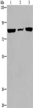 Gel: 6%SDS-PAGE, Lysate: 40 μg, Lane 1-3: A549 cells, mouse heart tissue, Hela cells, Primary antibody: LEPREL2 Antibody(LEPREL2 Antibody) at dilution 1/300, Secondary antibody: Goat anti rabbit IgG at 1/8000 dilution, Exposure time: 20 seconds