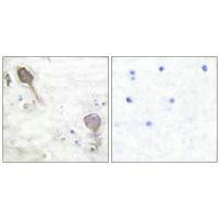 Immunohistochemical analysis of paraffin-embedded human brain tissue using Parkin antibody.Rabbit anti-Human PRKN Polyclonal Antibody