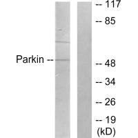 Western blot analysis of extracts from Jukat cells, using Parkin antibody.Rabbit anti-Human PRKN Polyclonal Antibody