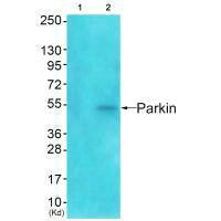 Western blot analysis of extracts from Jurkat cells using Parkin antibody. The lane on the left is treated with synthesized peptide.Rabbit anti-Human PRKN Polyclonal Antibody